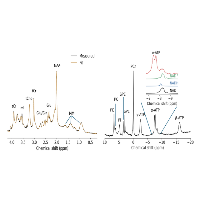 1H and 31P MRS spectra, Figure 1